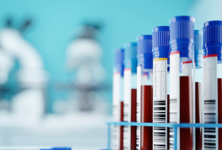 mit Blut gefüllte Probenröhrchen